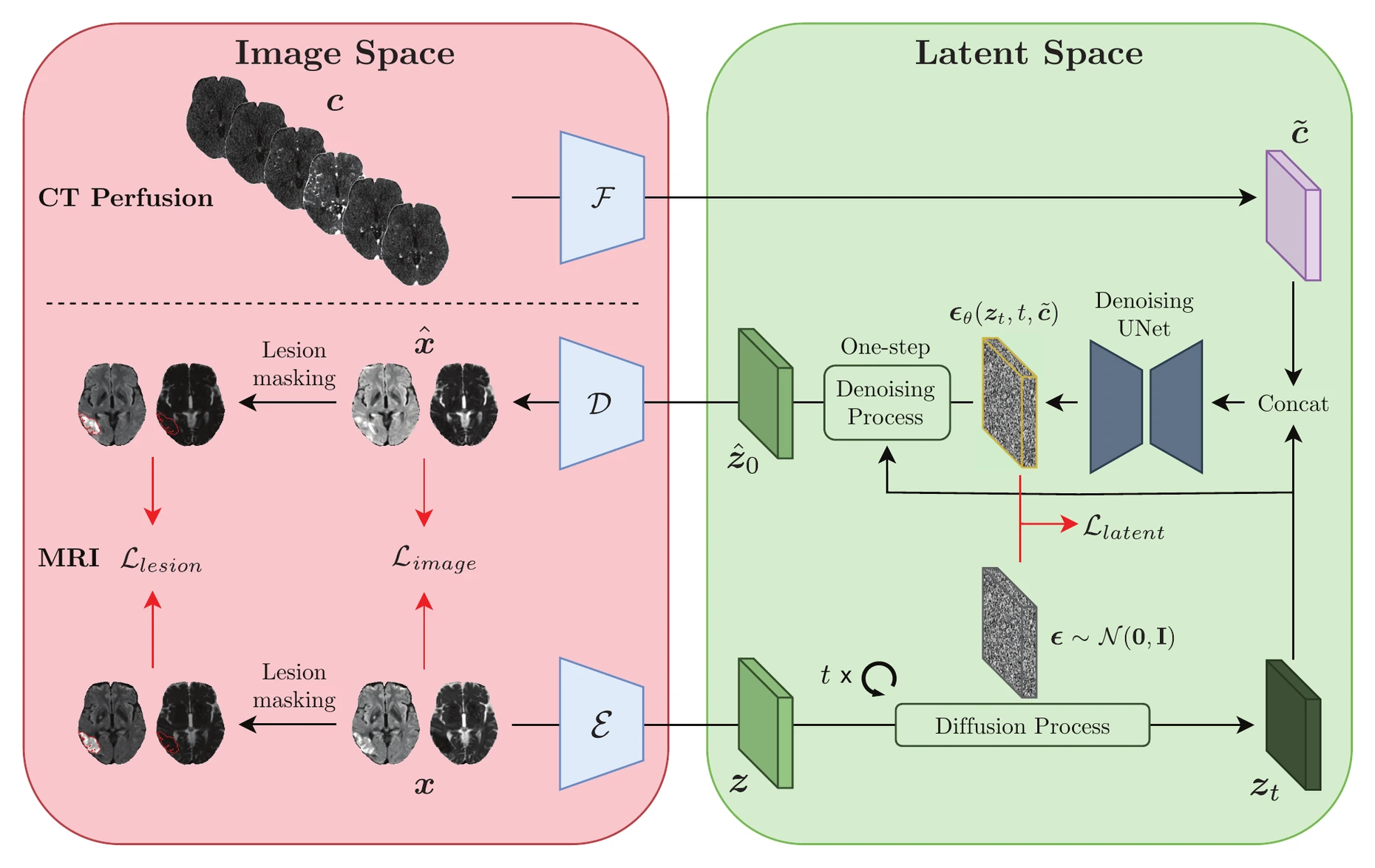 Lesion-aware post-training: CT perfusion conditions a latent diffusion model; one-step denoised latents are decoded to image space and trained with lesion-masked and image losses.